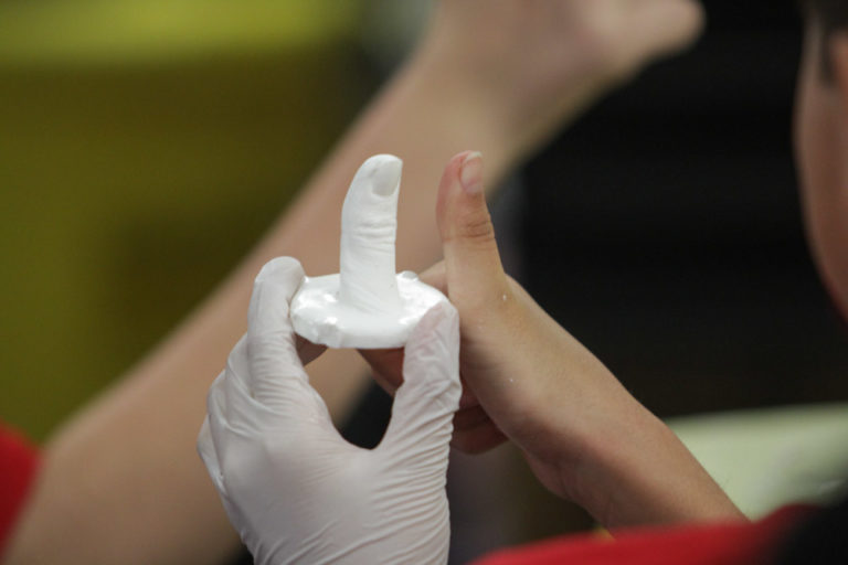 » Finished thumb cast.