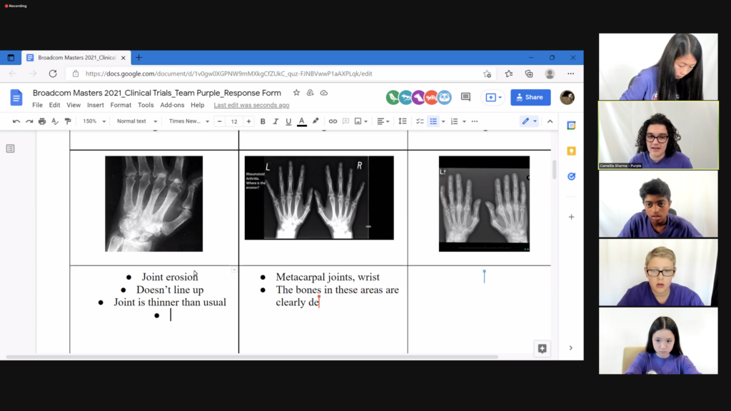 Broadcom MASTERS finalists look at x-rays showing rheumatoid arthritis during the JASON learning challenge