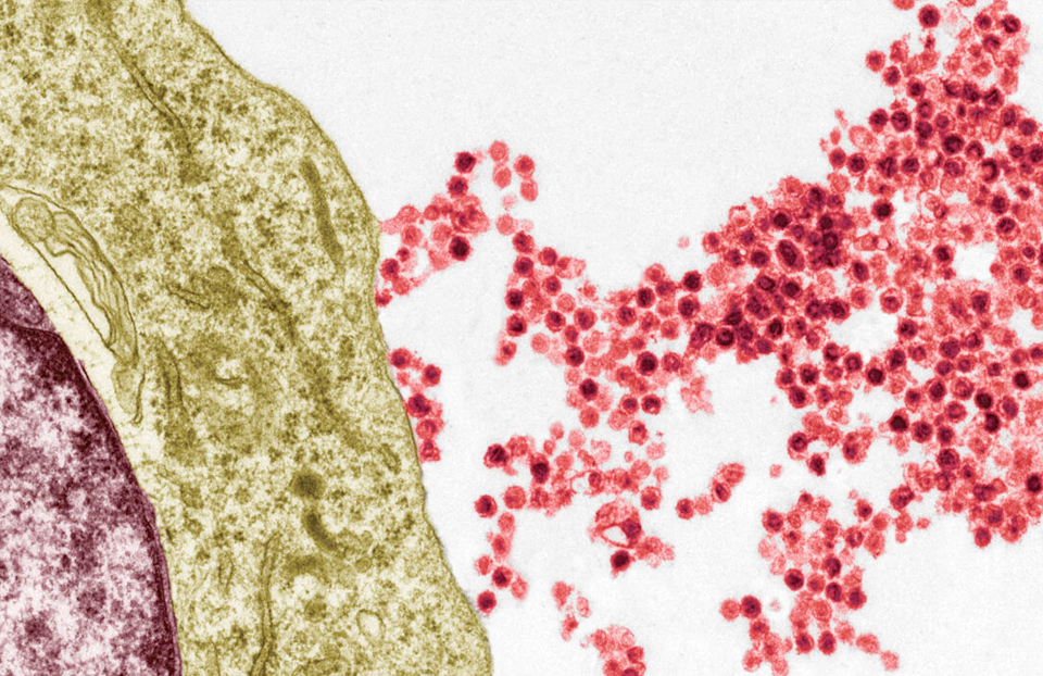 Epstein-Barr viruses (red) emerge from an immune system B cell in this colorized electron micrograph. STEVE GSCHMEISSNER/SCIENCE SOURCE