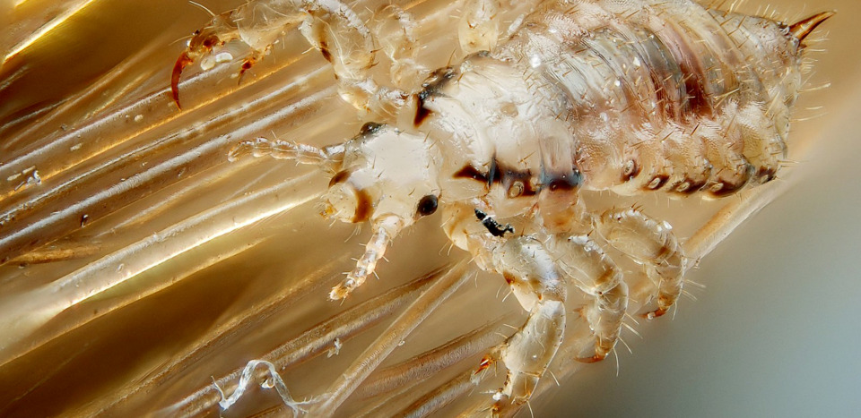Image of a human head louse